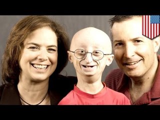 17-year-old dies from extremely rare aging disease