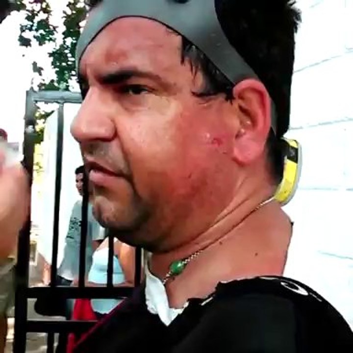 Juan Hernández reportero gráfico de agencia internacional herido en la cara por la GNB en Valencia