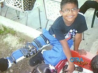 Otra Visión: La historia de Braian y la neurofibromatosis