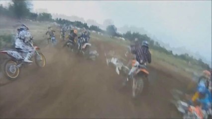 Rider Gets Arm Broken! - Crazy Dirt Bike Crash