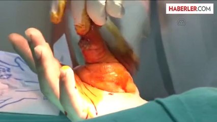 Tanzanyalı Doktor Erzurum'da Hastalara Şifa Dağıtıyor