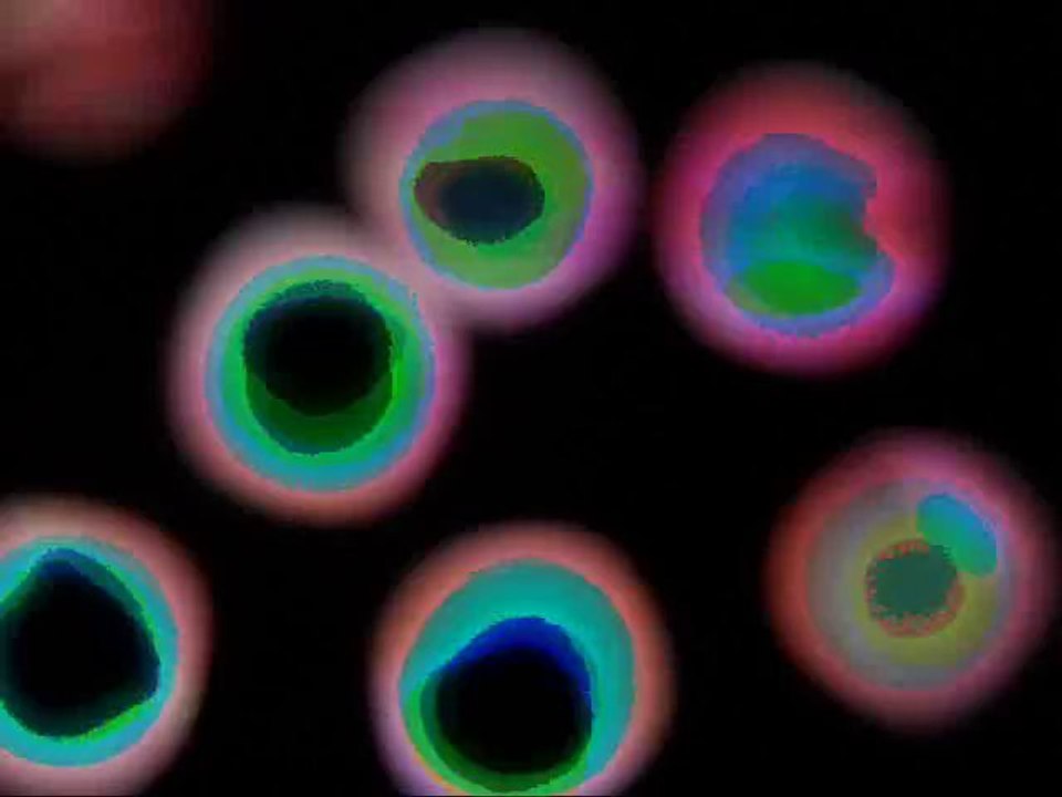Ugress...Snowball Windmill Particles