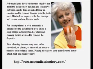 Oral piercing side-effects on your dental health