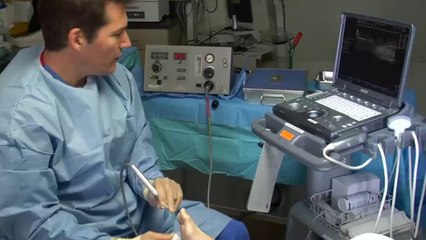 Feet For Life Centers: Cryo Neuroma Surgery Dr. M. Horwitz