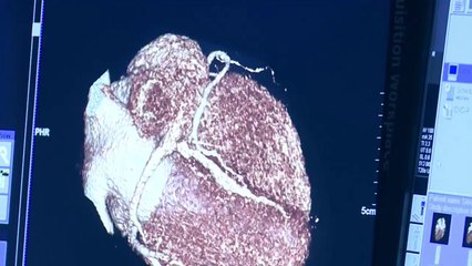 Flash CT hangi amaçlarla kullanılır?