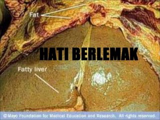Tonik Hati Al Jabbar