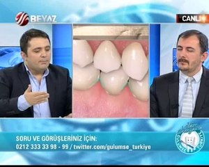 Gülümse Türkiye 09.02.2014