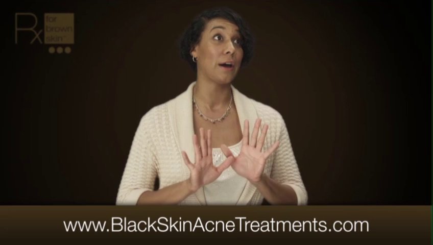 what is the best acne treatment for black skin- RX