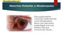 Puntos Que Flotan En La Vision: Como Combatir Los Molestosos Puntos Que Flotan En La Vision