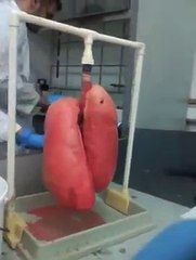 Pulmones sanos VS Pulmones de fumador