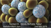 Detroit Coolsculpting, Clarkston Dermatology, Dr. Wendy L. McFalda