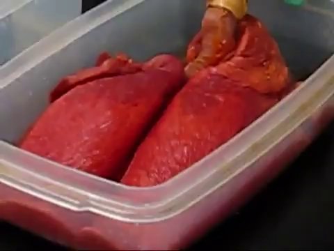 Poumons sains vs Poumons de fumeur