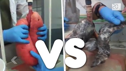 Fumeur vs non fumeur