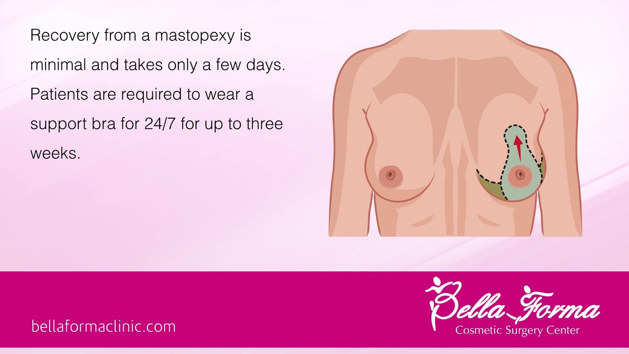 Breast Lift Surgery - Mastopexy Atlanta