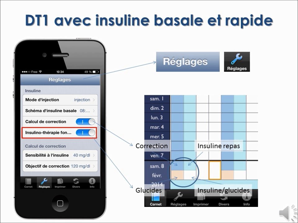 Diabphone Carnet:  description des différents carnets selon le type de diabète et le mode de traitement