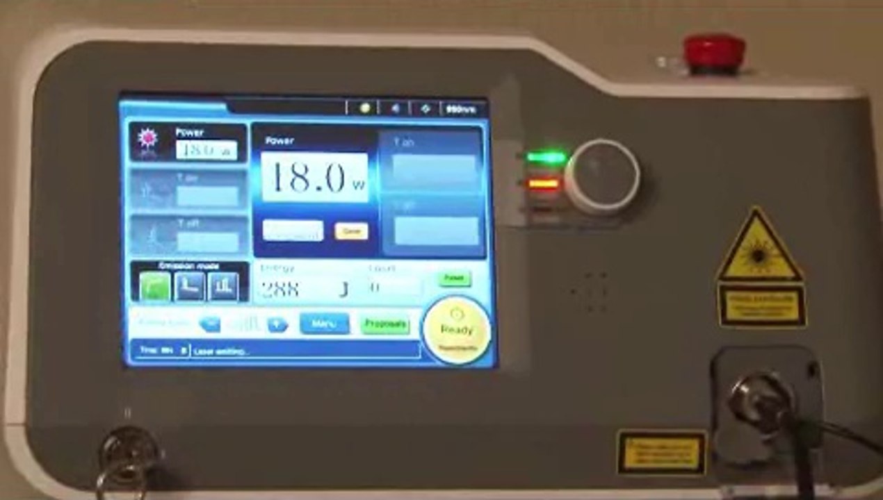 Laser Therapy for Unsightly Toenails - DC Metro Area and Laurel, MD - Podiatrist Mitchell Barbe