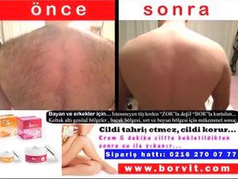 TÜY DÖKÜCÜ KREM KILLARDAN KURTULUN