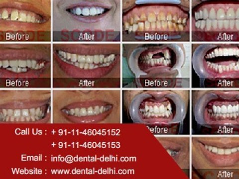 Cosmetic Dentist Clinic in New Delhi, Cosmetic Dentist South Delhi, Cosmetic dentistry clinic in Green park