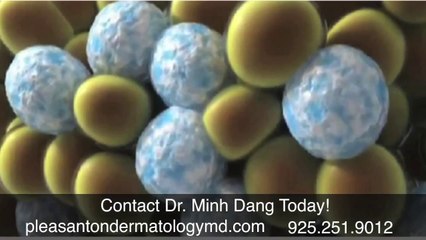 Coolsculpting Pleasanton, Dr. Minh Dang
