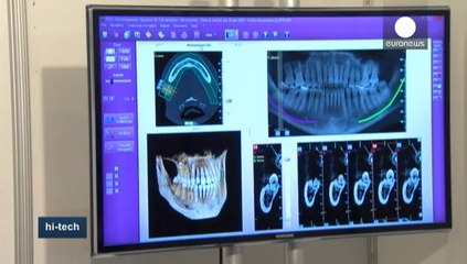 Dentisti in 3D. Tutte le novità dalla fiera "Imagina" a Montecarlo