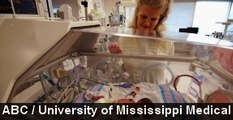 Mom Expecting Triplets Gives Birth To Identical Quadruplets