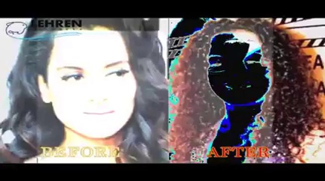 Bollywood Celebs Obsessed With Cosmetic Surgeries _ Latest Bollywood Gossip