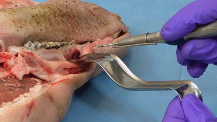 Tariq Drabu Explains the Instruments Required To Maintain A Flap Raised