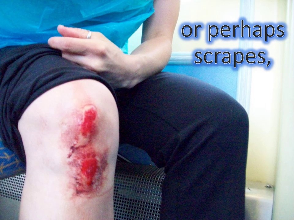 Some Types of Accidents That a Personal Injury Lawyer Might Help You