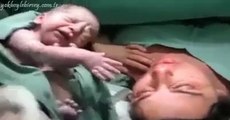 Yeni Doğan Bebeğin Annesinden Ayrılmak İstememesi