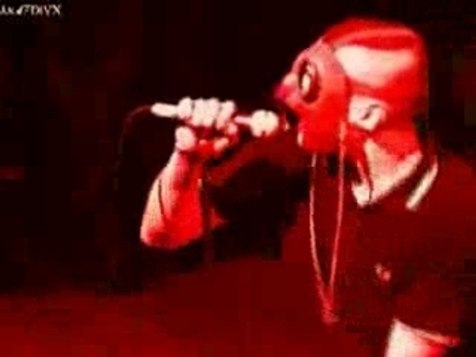 berurier noir- lobotomie