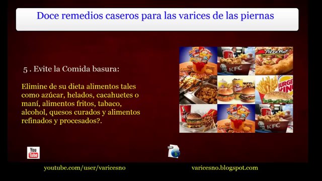 Doce remedios caseros para las varices