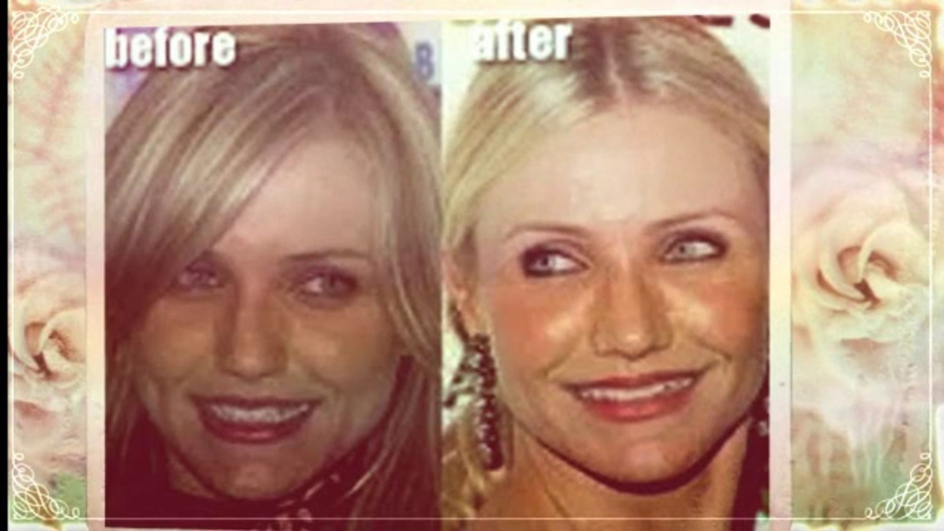Cameron Diaz Plastic Surgery