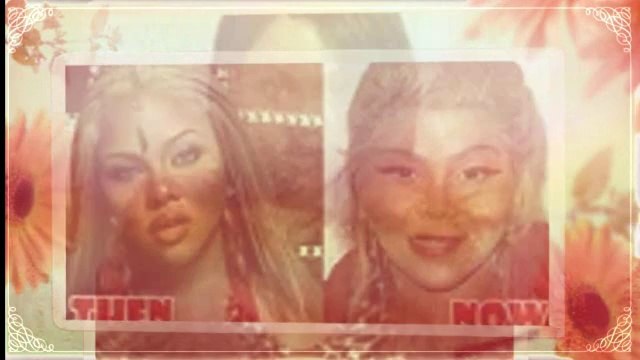 Lil Kim Plastic Surgery
