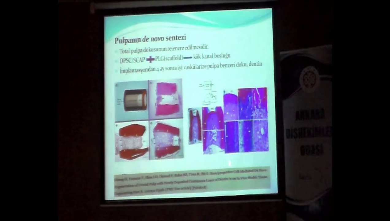 DR.DİŞHEKİMİ FUNDA YILMAZ KARAN 20 ŞUBAT 2014 ADO EĞİTİM SEMİNERİ