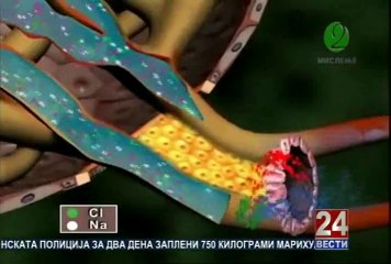 Второ мислење 22-02-2014