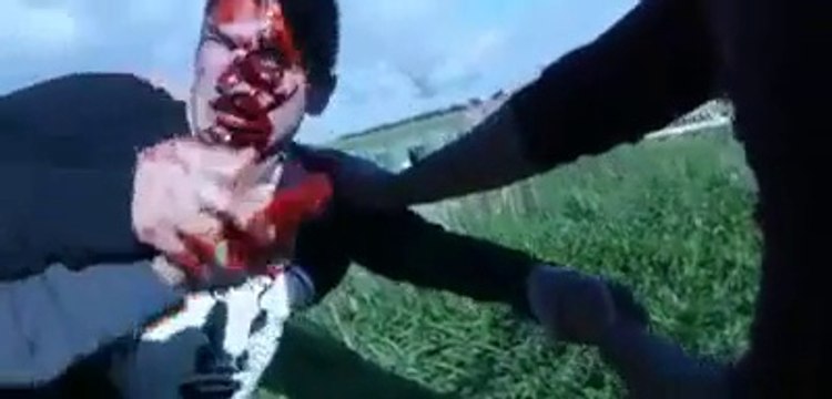 Dumb teenager fail : Ball right in the head! Breaking bones...