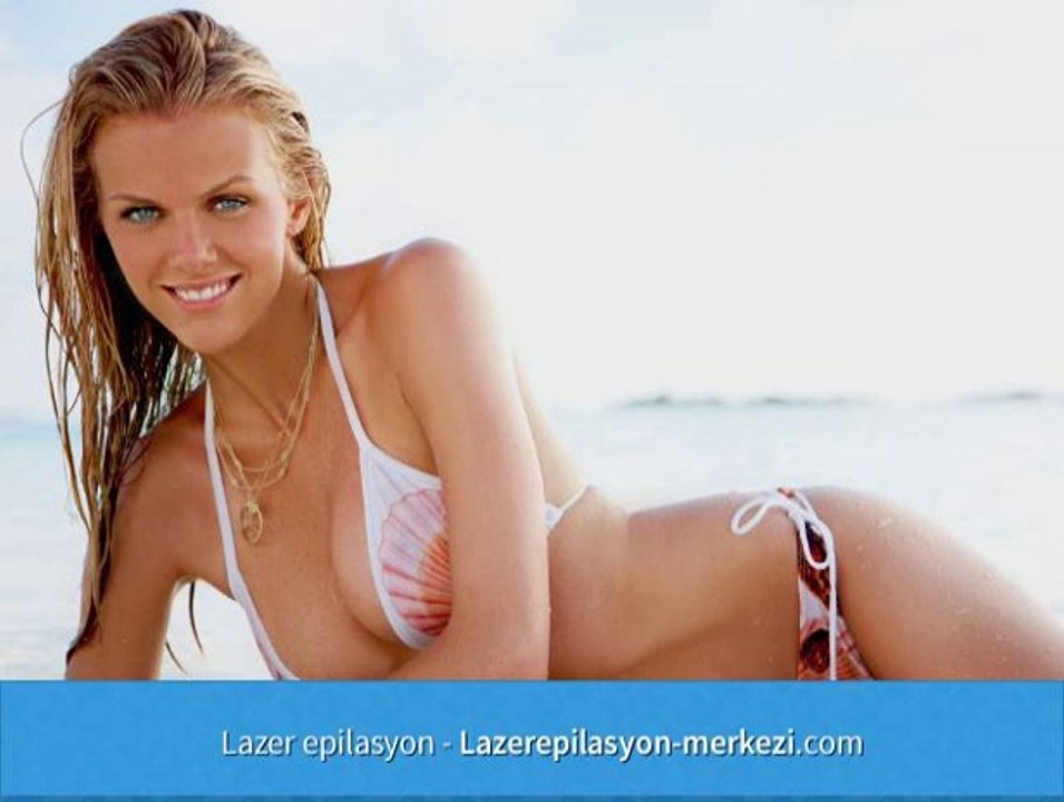 Lazer Epilasyon Wiki