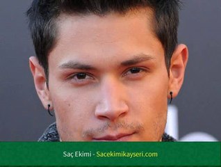 Saç Ekimi Zararlı Mı