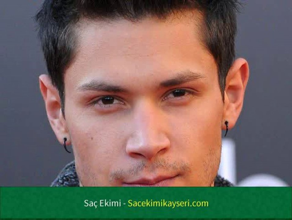 Saç Ekimi Zararlı Mı