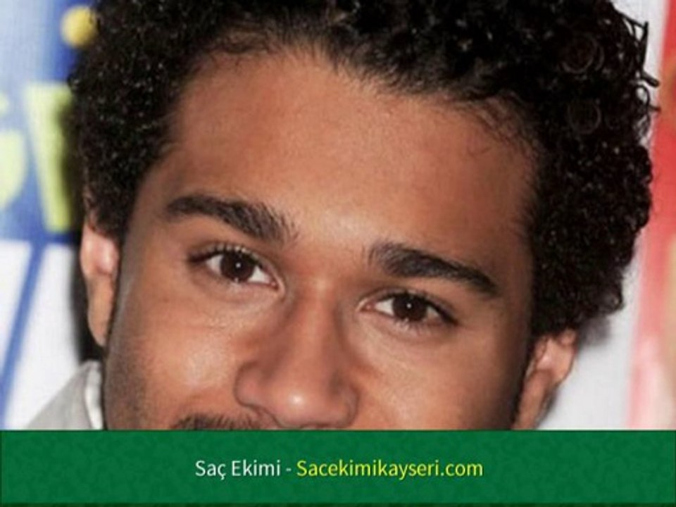 Saç Ekimi Uzmanları