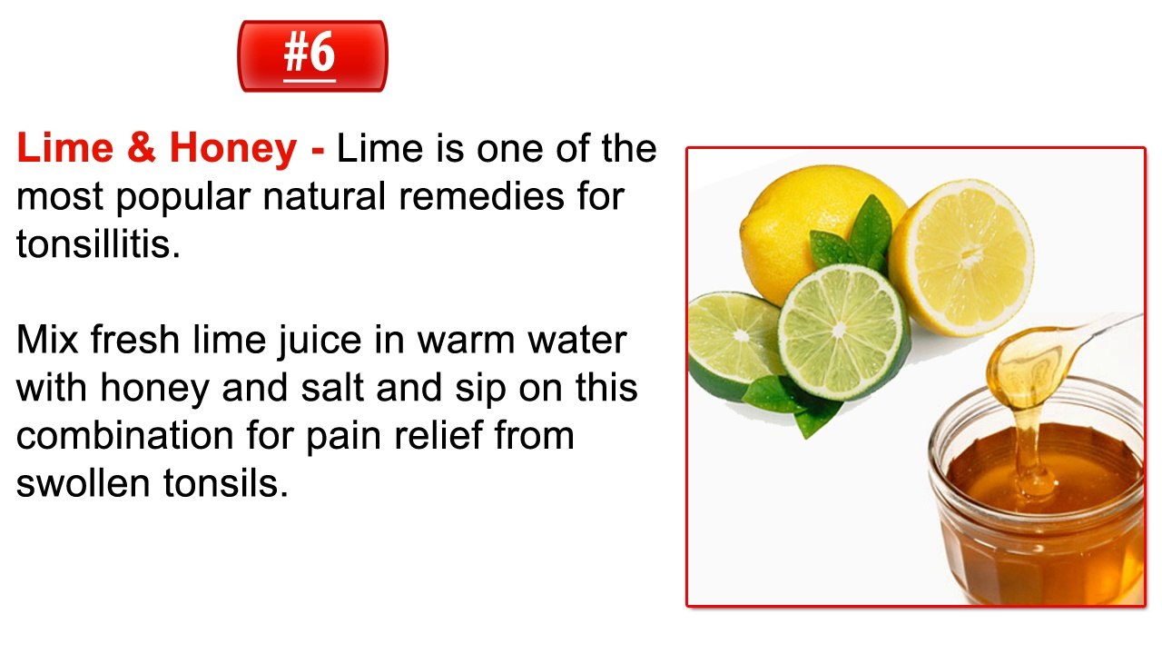 6 Soft Foods to Eat When You Have Tonsil Stones (Tonsillitis)? - UD Visions