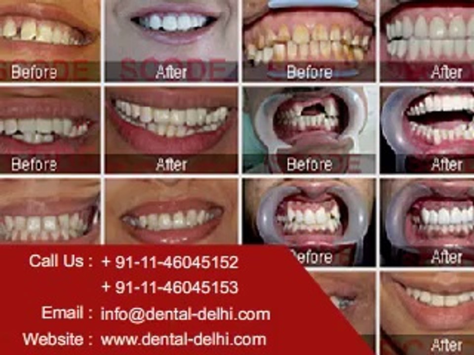 Dental Clinic in New Delhi, Dentist in South Delhi, Dental Implants Clinic in Delhi