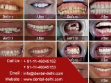 Cosmetic Dental Clinic in New Delhi, South Delhi, Delhi India