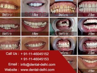 Cosmetic Dental Clinic in New Delhi, South Delhi, Delhi India