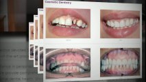 Smile Again Dental Reviews