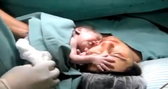Yeni Doğmuş Bebeğin Annesinden Ayrılmak İstememesi