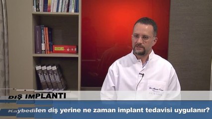 Kaybedilen diş yerine ne zaman implant tedavisi uygulanır?