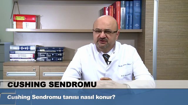 Cushing Sendromu tanısı nasıl konur?