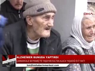 05-ALZHEİMER hastalıgı