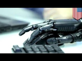 Alfred Mann Foundation announces the first implantation of myoelectric prosthetic hand